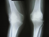 coimbatore-orthopaedic-joint-replacement-maternity-child-welfare-centre-india